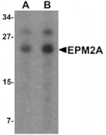 Western blot - EPM2A Antibody from Signalway Antibody (25537) - Antibodies.com