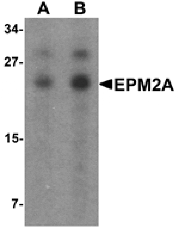Western blot - EPM2A Antibody from Signalway Antibody (25537) - Antibodies.com