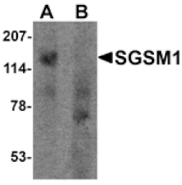 Western blot - SGSM1 Antibody from Signalway Antibody (25539) - Antibodies.com