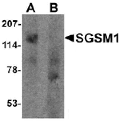 Western blot - SGSM1 Antibody from Signalway Antibody (25539) - Antibodies.com