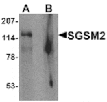 Western blot - SGSM2 Antibody from Signalway Antibody (25540) - Antibodies.com