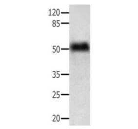 ACTG1 Antibody from Signalway Antibody (31004) - Antibodies.com