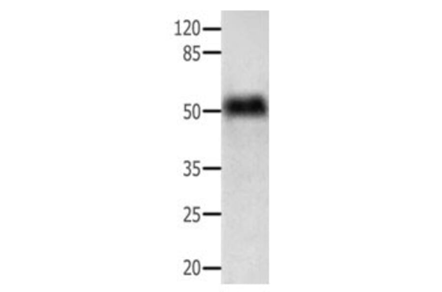 ACTG1 Antibody from Signalway Antibody (31004) - Antibodies.com