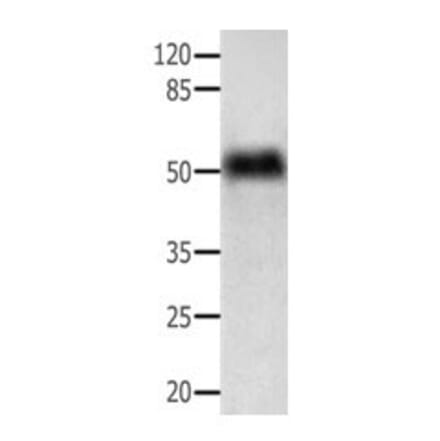 ACTG1 Antibody from Signalway Antibody (31004) - Antibodies.com