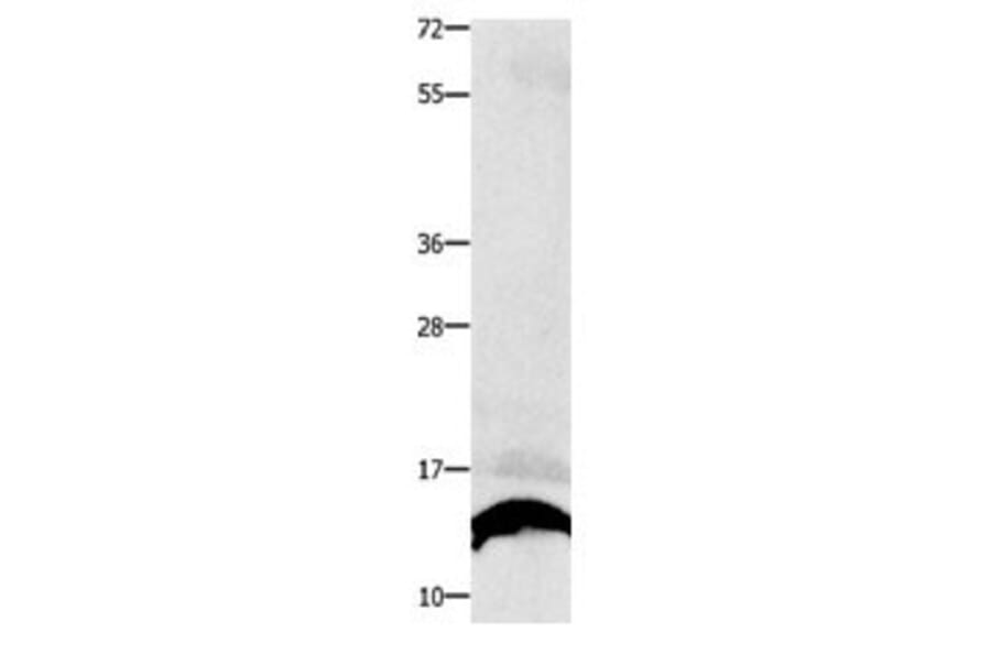 COX5B Antibody from Signalway Antibody (31016) - Antibodies.com
