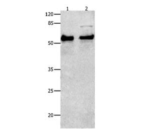 SMAD4 Antibody from Signalway Antibody (31017) - Antibodies.com
