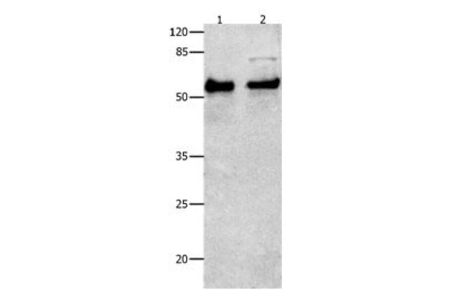SMAD4 Antibody from Signalway Antibody (31017) - Antibodies.com