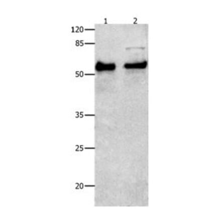 SMAD4 Antibody from Signalway Antibody (31017) - Antibodies.com