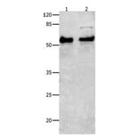 SMAD4 Antibody from Signalway Antibody (31017) - Antibodies.com