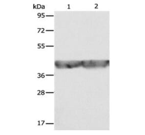 ALDOA Antibody from Signalway Antibody (31028) - Antibodies.com