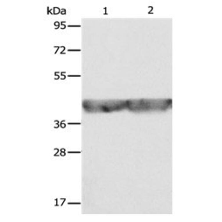 ALDOA Antibody from Signalway Antibody (31028) - Antibodies.com