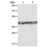 ALDOA Antibody from Signalway Antibody (31028) - Antibodies.com