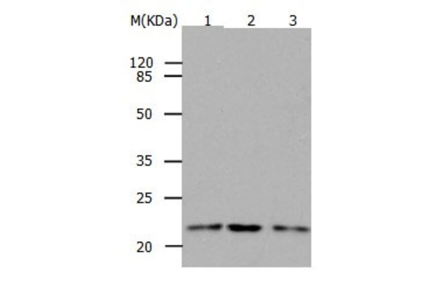 RAP1B Antibody from Signalway Antibody (31033) - Antibodies.com