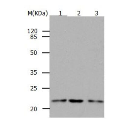 RAP1B Antibody from Signalway Antibody (31033) - Antibodies.com