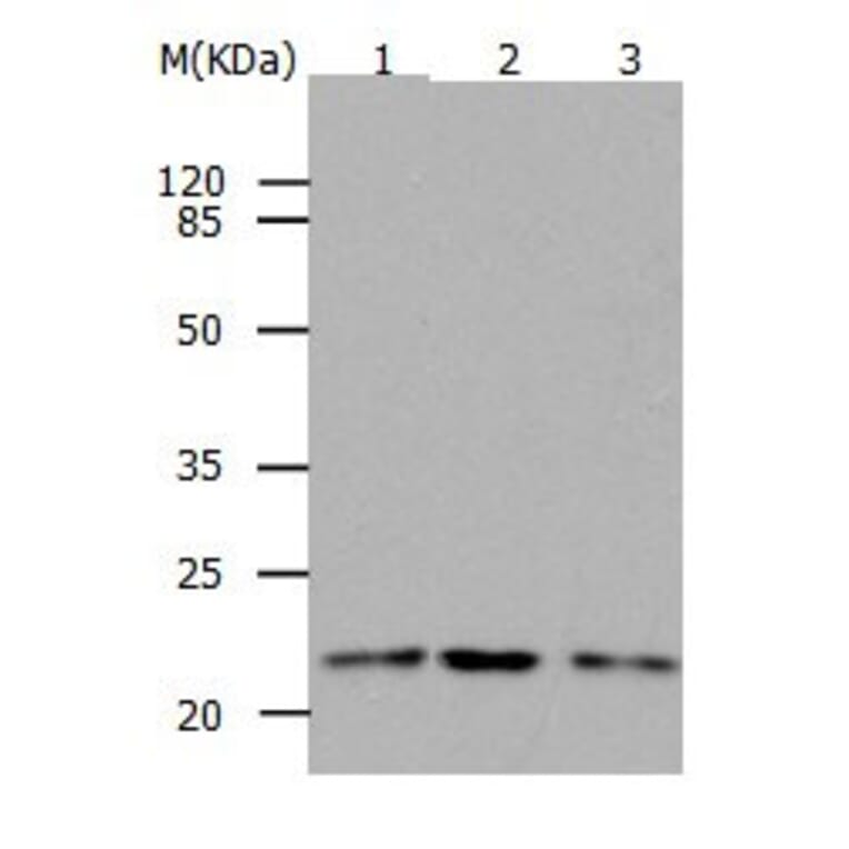 RAP1B Antibody from Signalway Antibody (31033) - Antibodies.com