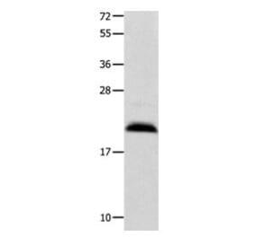 FGF12 Antibody from Signalway Antibody (31036) - Antibodies.com