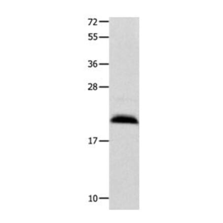 FGF12 Antibody from Signalway Antibody (31036) - Antibodies.com