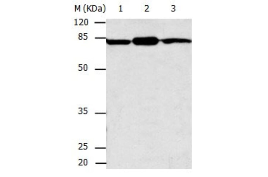 CAPN2 Antibody from Signalway Antibody (31039) - Antibodies.com
