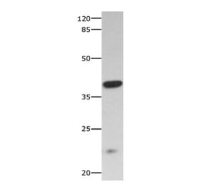 CNTFR Antibody from Signalway Antibody (31061) - Antibodies.com
