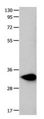 Gel: 10%+12% SDS-PAGE Lysate: 40 µg Mouse heart tissue lysate Primary antibody: 1/250 dilution Secondary antibody: Goat anti Rabbit IgG - H&L (HRP) at 1/10000 dilution Exposure time: 10 seconds