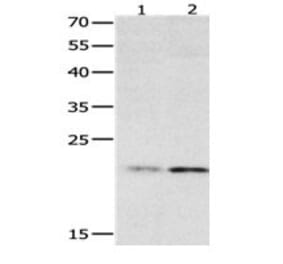 HMGB4 Antibody from Signalway Antibody (31080) - Antibodies.com