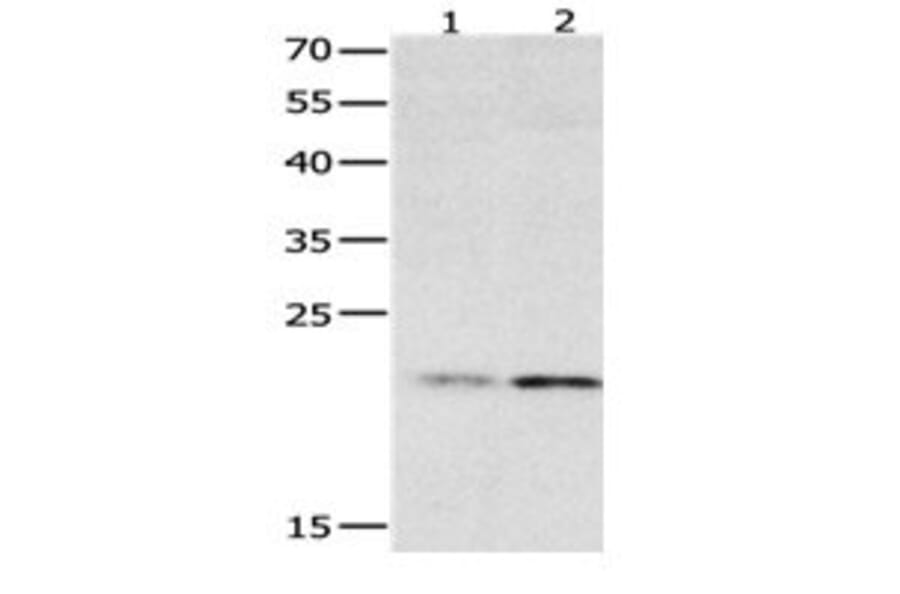 HMGB4 Antibody from Signalway Antibody (31080) - Antibodies.com