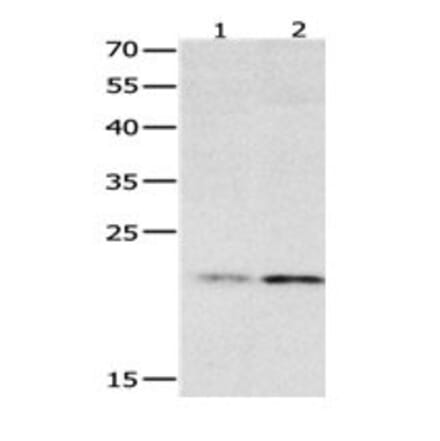HMGB4 Antibody from Signalway Antibody (31080) - Antibodies.com
