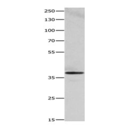 HMOX2 Antibody from Signalway Antibody (31081) - Antibodies.com