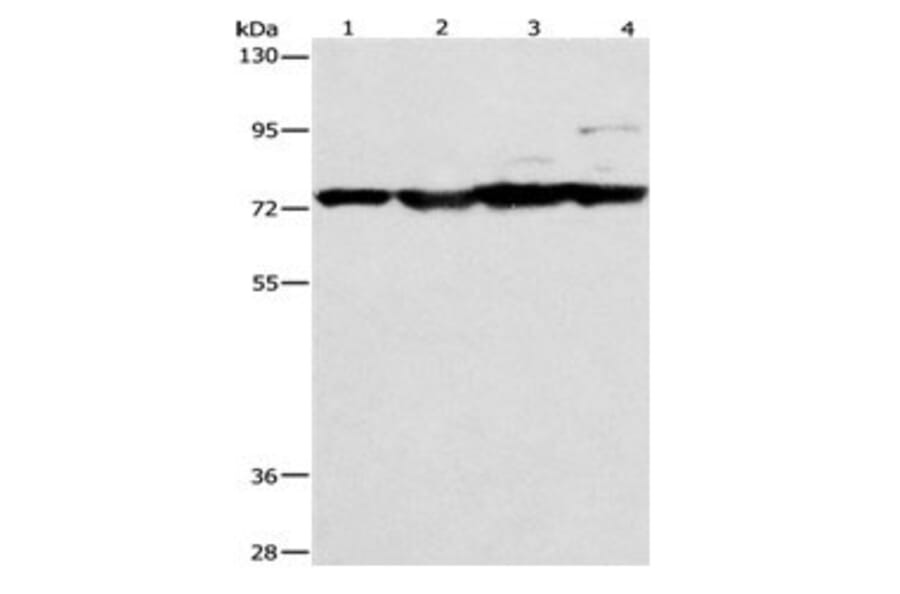 MMP15 Antibody from Signalway Antibody (31100) - Antibodies.com