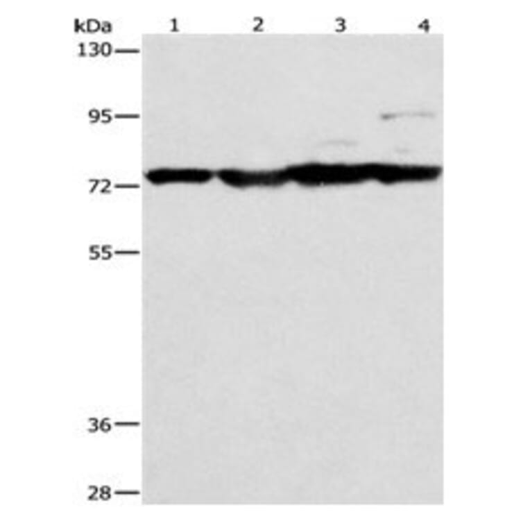 MMP15 Antibody from Signalway Antibody (31100) - Antibodies.com