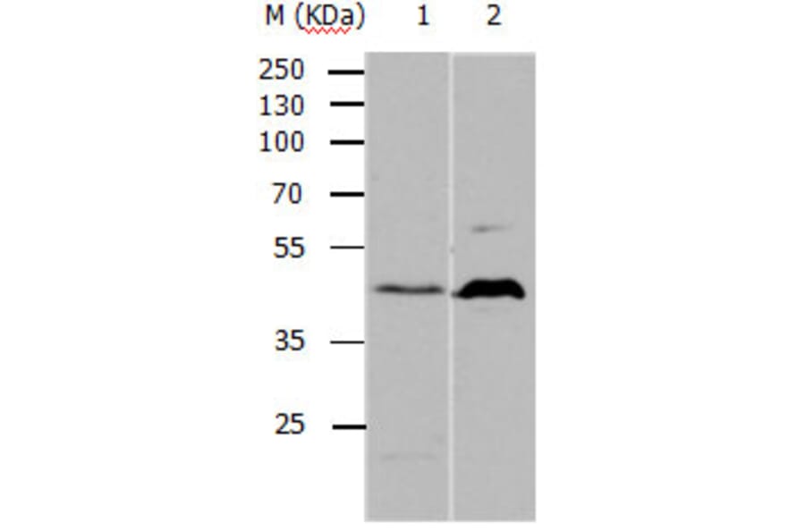 5HT1A Antibody from Signalway Antibody (31139) - Antibodies.com