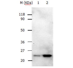 RAB5A Antibody from Signalway Antibody (31147) - Antibodies.com