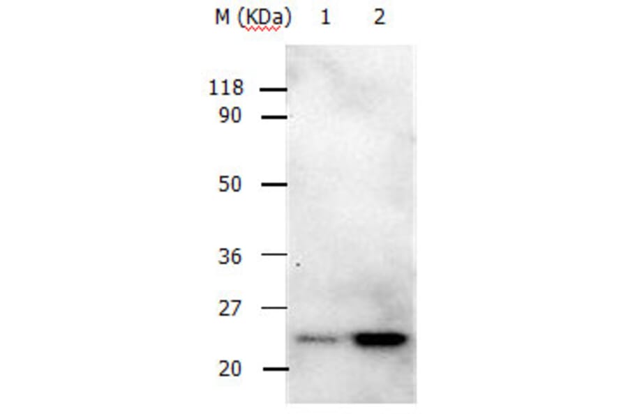 RAB5A Antibody from Signalway Antibody (31147) - Antibodies.com