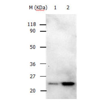 RAB5A Antibody from Signalway Antibody (31147) - Antibodies.com