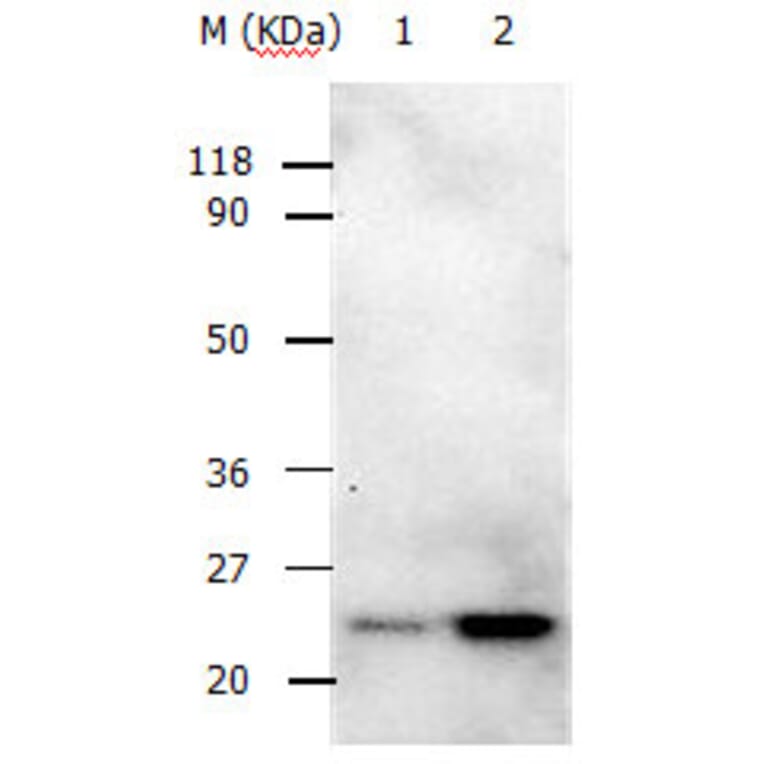 RAB5A Antibody from Signalway Antibody (31147) - Antibodies.com