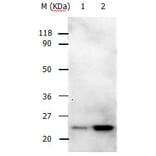 RAB5A Antibody from Signalway Antibody (31147) - Antibodies.com