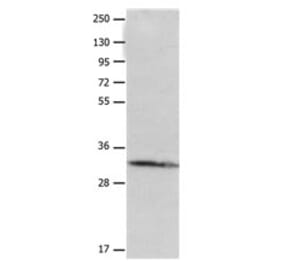 AQP10 Antibody from Signalway Antibody (31177) - Antibodies.com