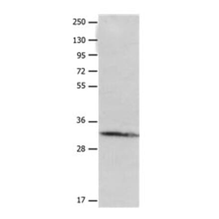 AQP10 Antibody from Signalway Antibody (31177) - Antibodies.com