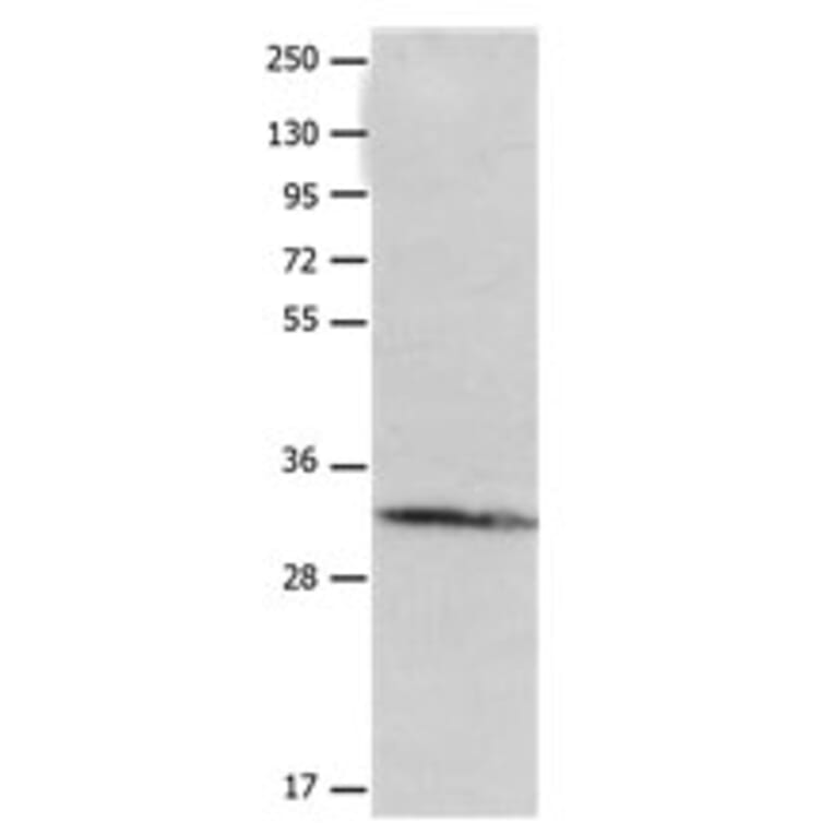 AQP10 Antibody from Signalway Antibody (31177) - Antibodies.com