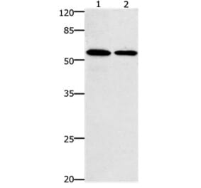 CCNB1 Antibody from Signalway Antibody (31178) - Antibodies.com