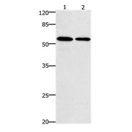 CCNB1 Antibody from Signalway Antibody (31178) - Antibodies.com