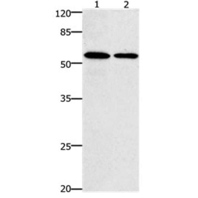 CCNB1 Antibody from Signalway Antibody (31178) - Antibodies.com