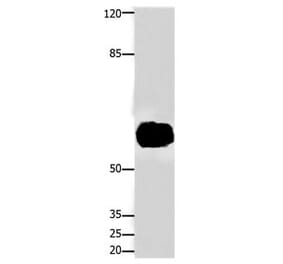 FOXJ3 Antibody from Signalway Antibody (31197) - Antibodies.com
