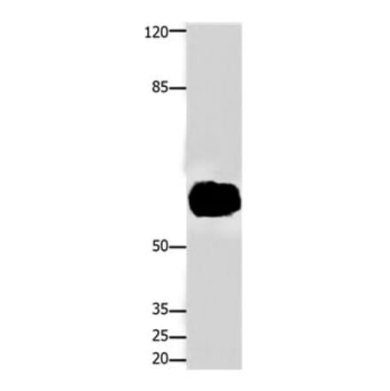 FOXJ3 Antibody from Signalway Antibody (31197) - Antibodies.com