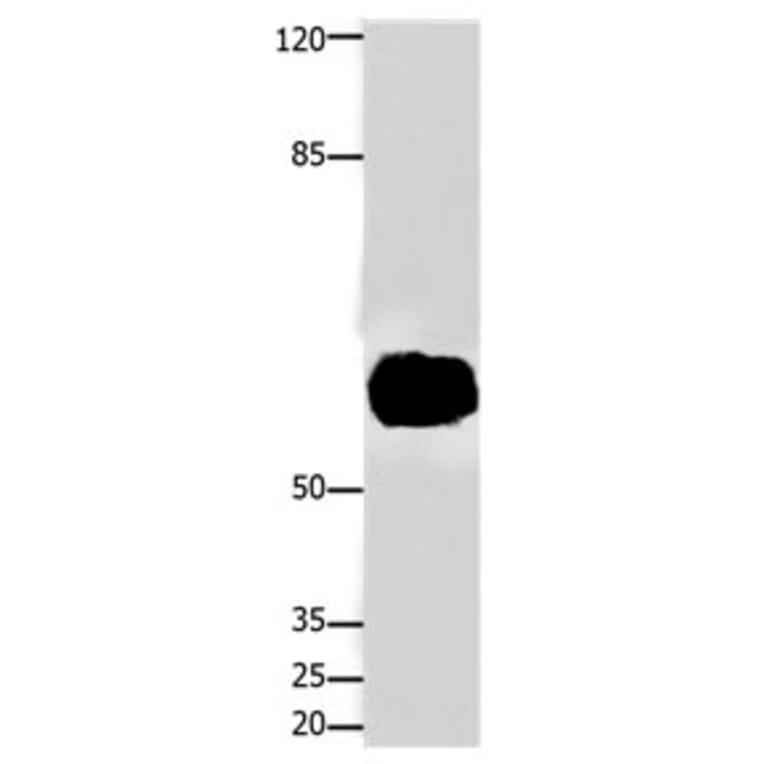 FOXJ3 Antibody from Signalway Antibody (31197) - Antibodies.com