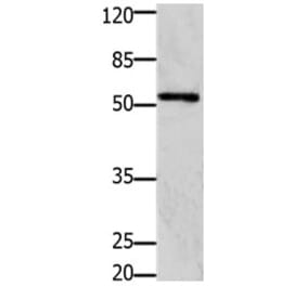 GFRA1 Antibody from Signalway Antibody (31205) - Antibodies.com