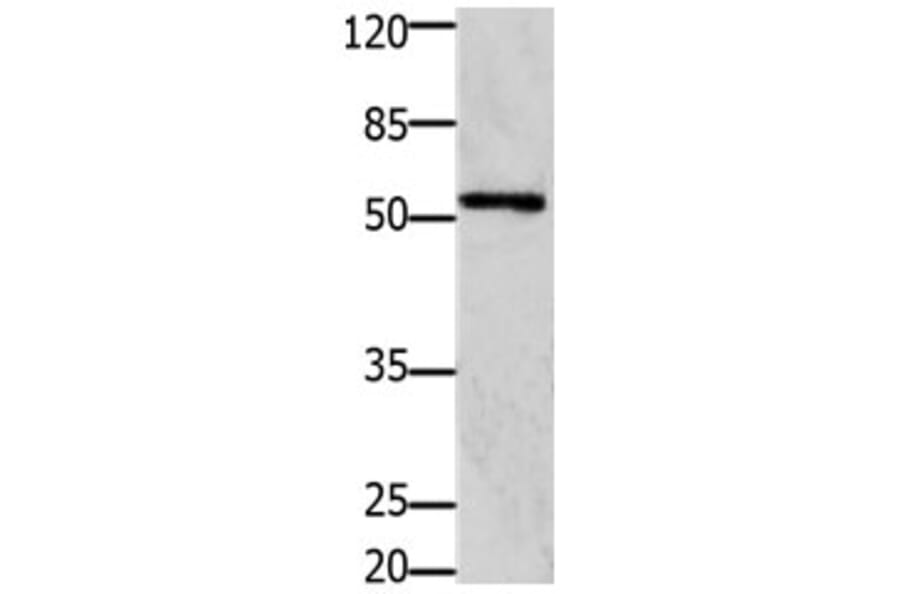 GFRA1 Antibody from Signalway Antibody (31205) - Antibodies.com