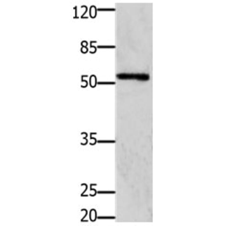 GFRA1 Antibody from Signalway Antibody (31205) - Antibodies.com