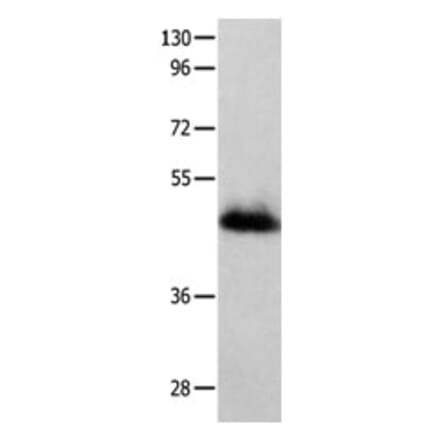 GFRA2 Antibody from Signalway Antibody (31206) - Antibodies.com