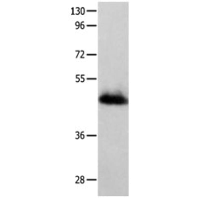GFRA2 Antibody from Signalway Antibody (31206) - Antibodies.com
